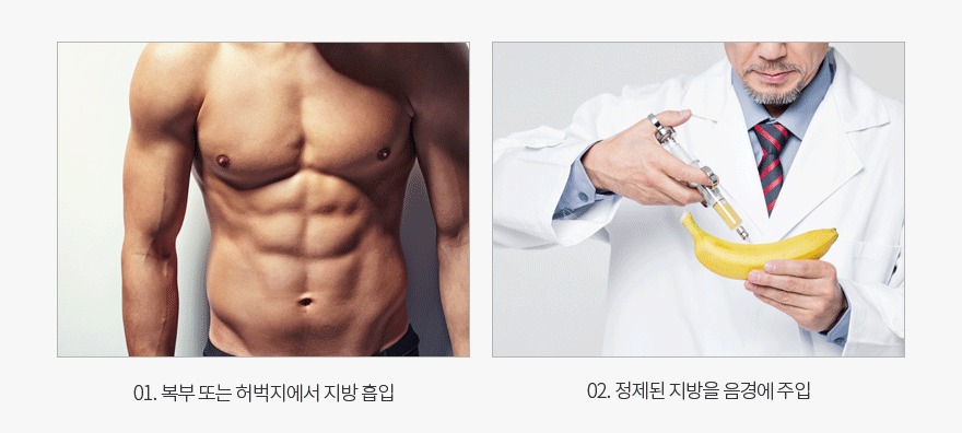 요로결석,신장, 요관, 방광에 생기는 돌
치료가 필요합니다.